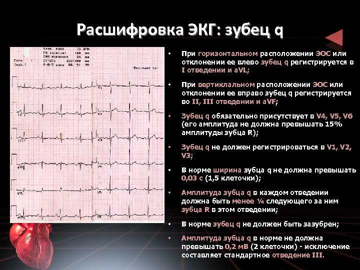 Гипертрофия миокарда сердца: признаки заболевания и его лечение