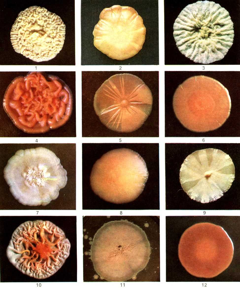 Формы колоний. Формы колоний микробиология. Формы колоний микроорганизмов. Различные колонии микроорганизмов. Формы колоний бактерий.