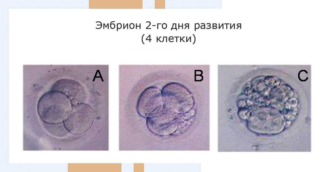 Почему во время развития in vitro иногда происходит остановка эмбриона? - reprolife київ