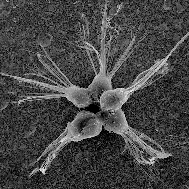 Хоанофлагеллята - choanoflagellate